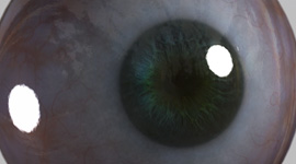 Frieza | Eye R&D